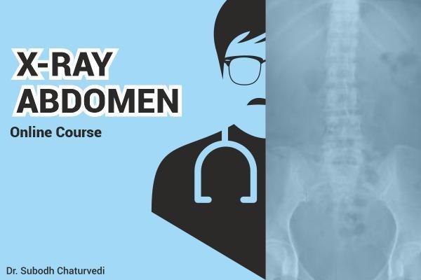 X-Ray Abdomen