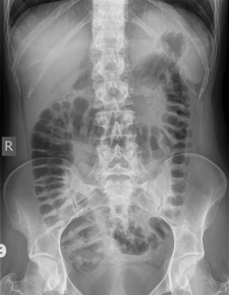 Medical X-Ray imaging