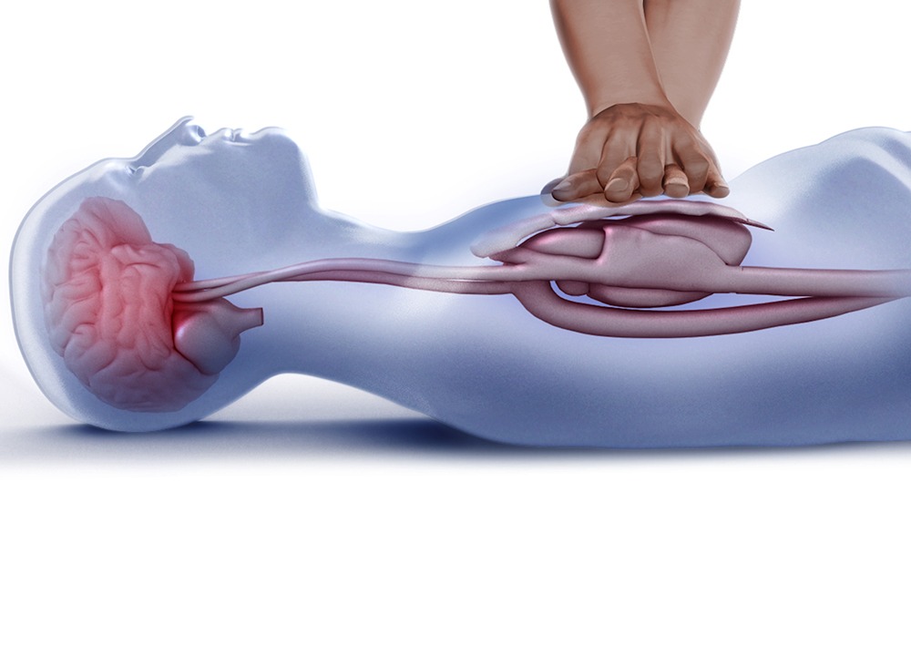 Hands-on CPR technique demonstration